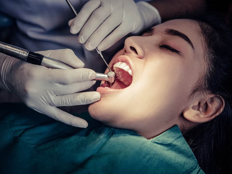 Dental Implants